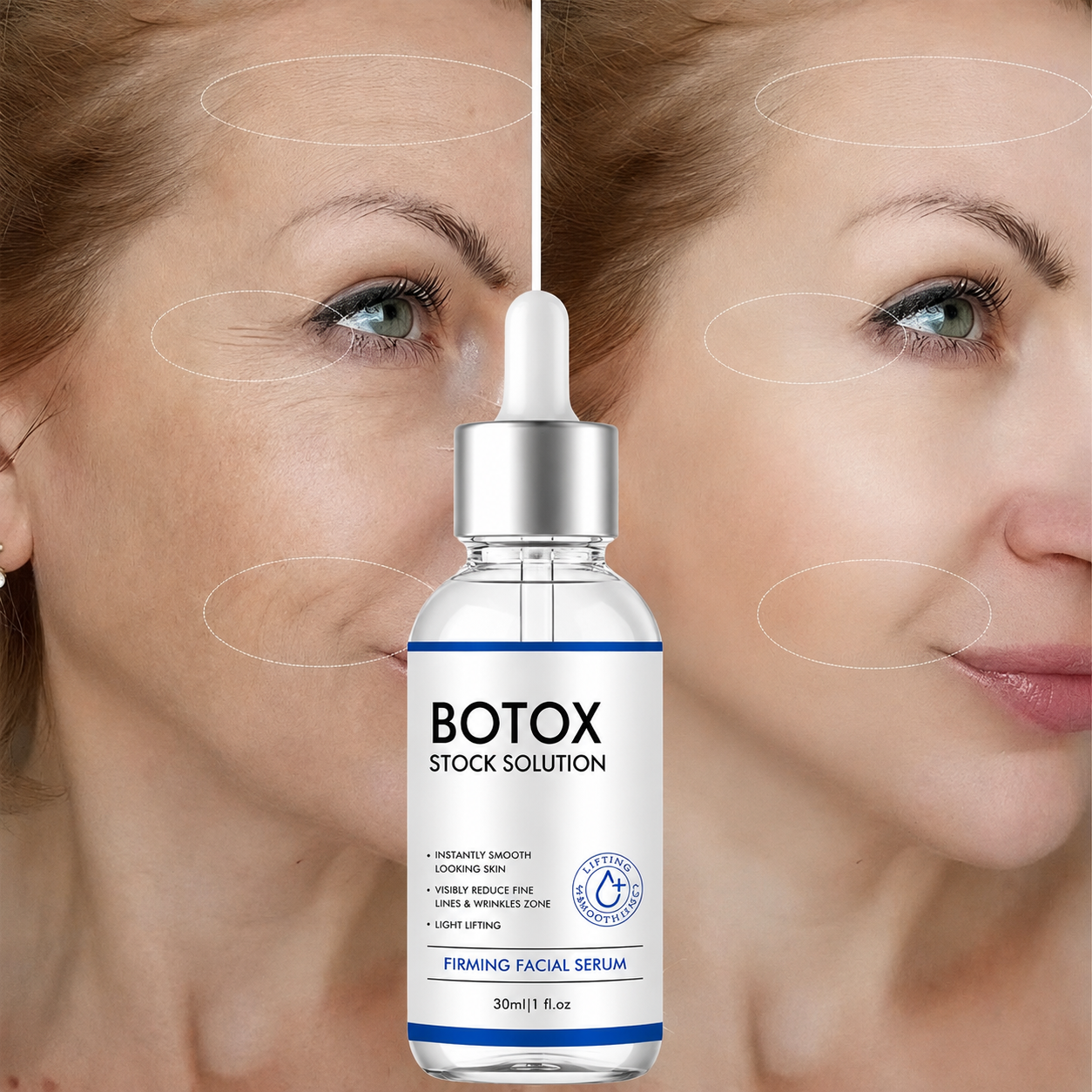 SkinLift™ | Botox-ansigtsserum