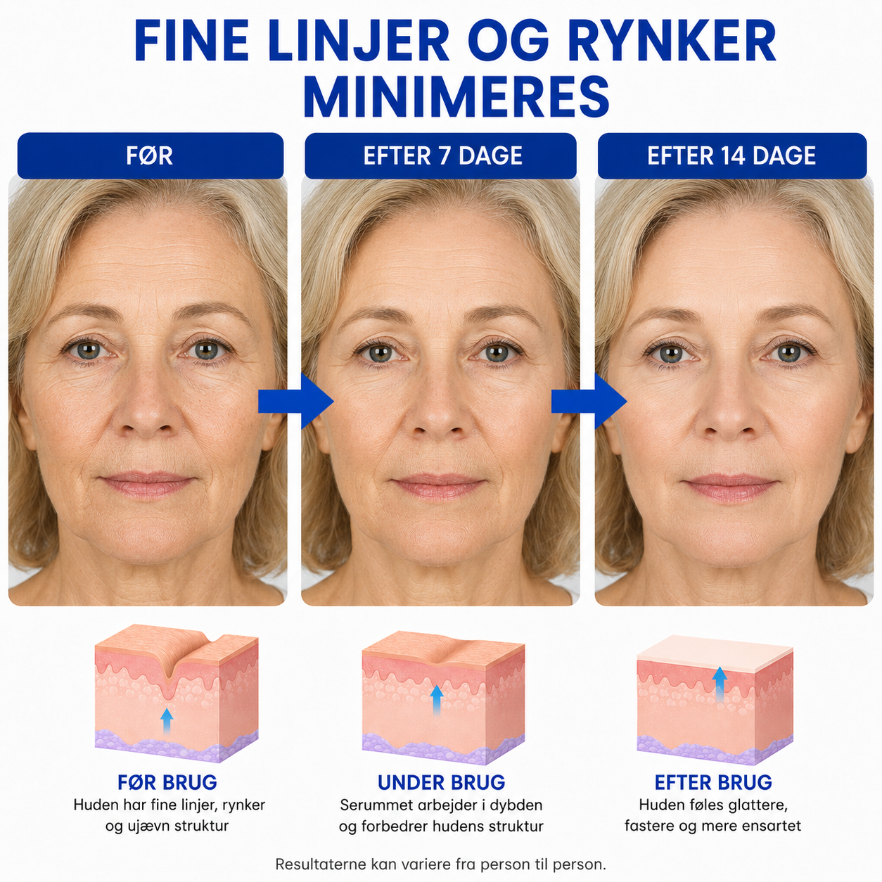 SkinLift™ | Botox-ansigtsserum