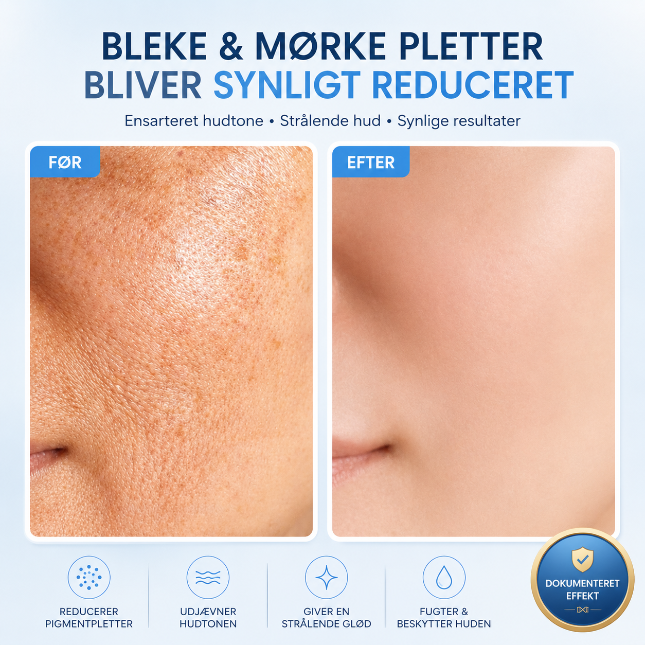 Lucents FirmLux™ | Opstrammende Creme