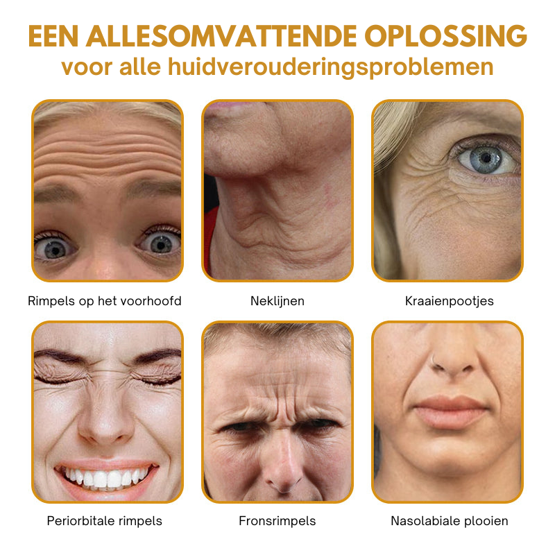 Anti-Wrinkle™ | Rynkereducerende Botox Creme