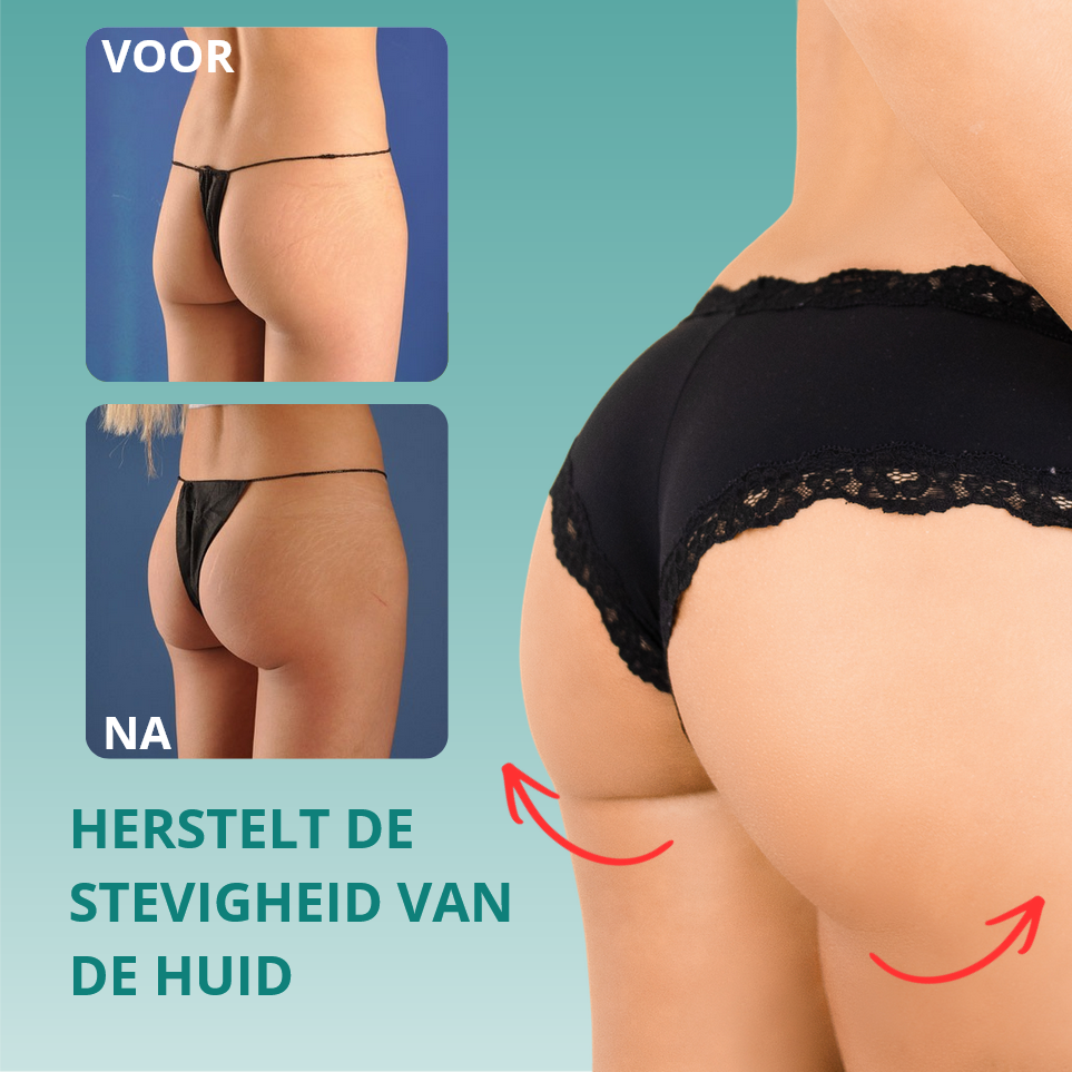 1+1 GRATIS: FirmLux™ | Verstevigende Crème