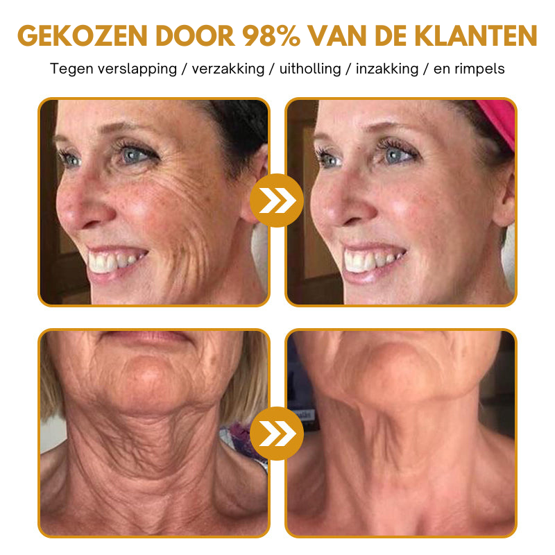 Anti-Wrinkle™ | Rynkereducerende Botox Creme
