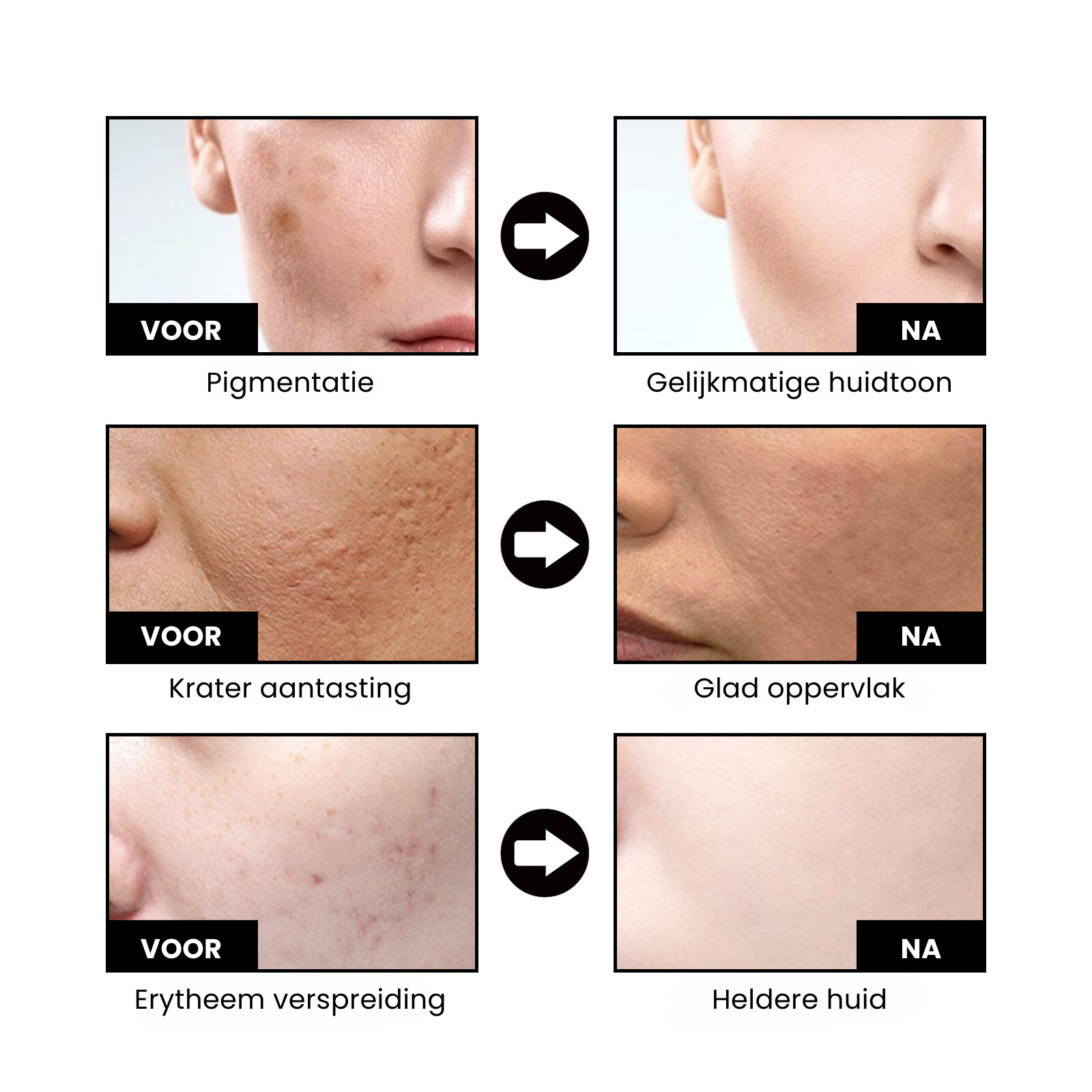 NiaRadiant™ | Hududglattende Serum