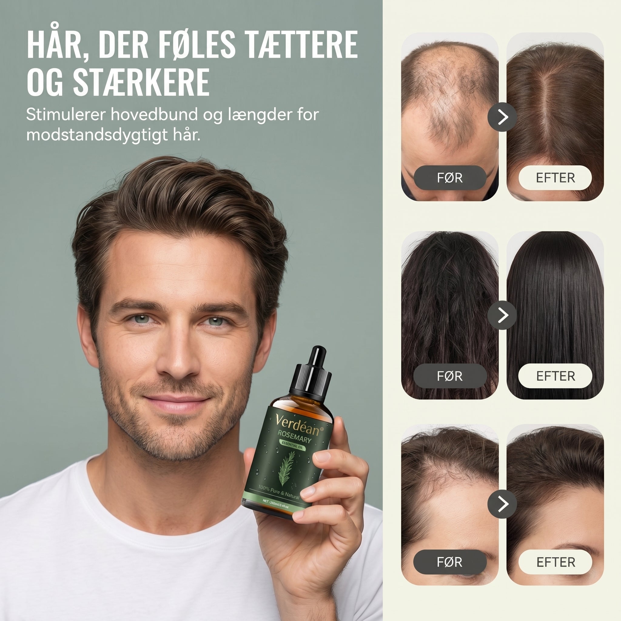 Verdéan™ Rosemary Hair Oil Serum Stimulerer hårvækst og gør dit hår synligt fyldigere og stærkere