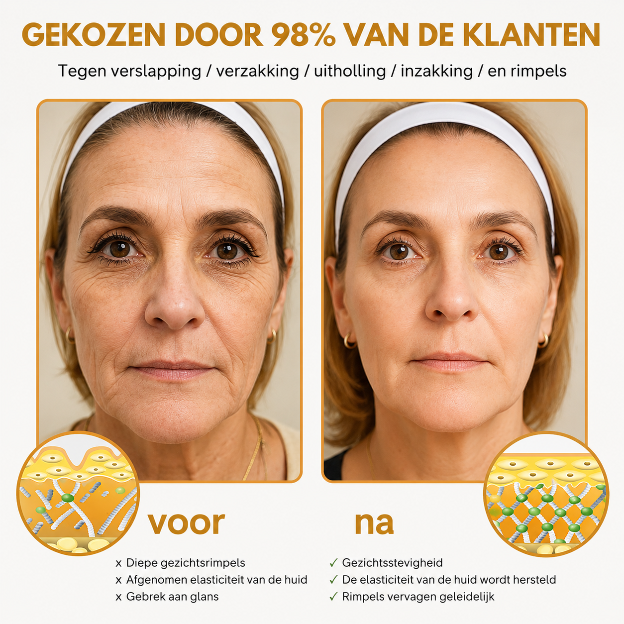 Anti-Wrinkle™ | Rynkereducerende Botox Creme