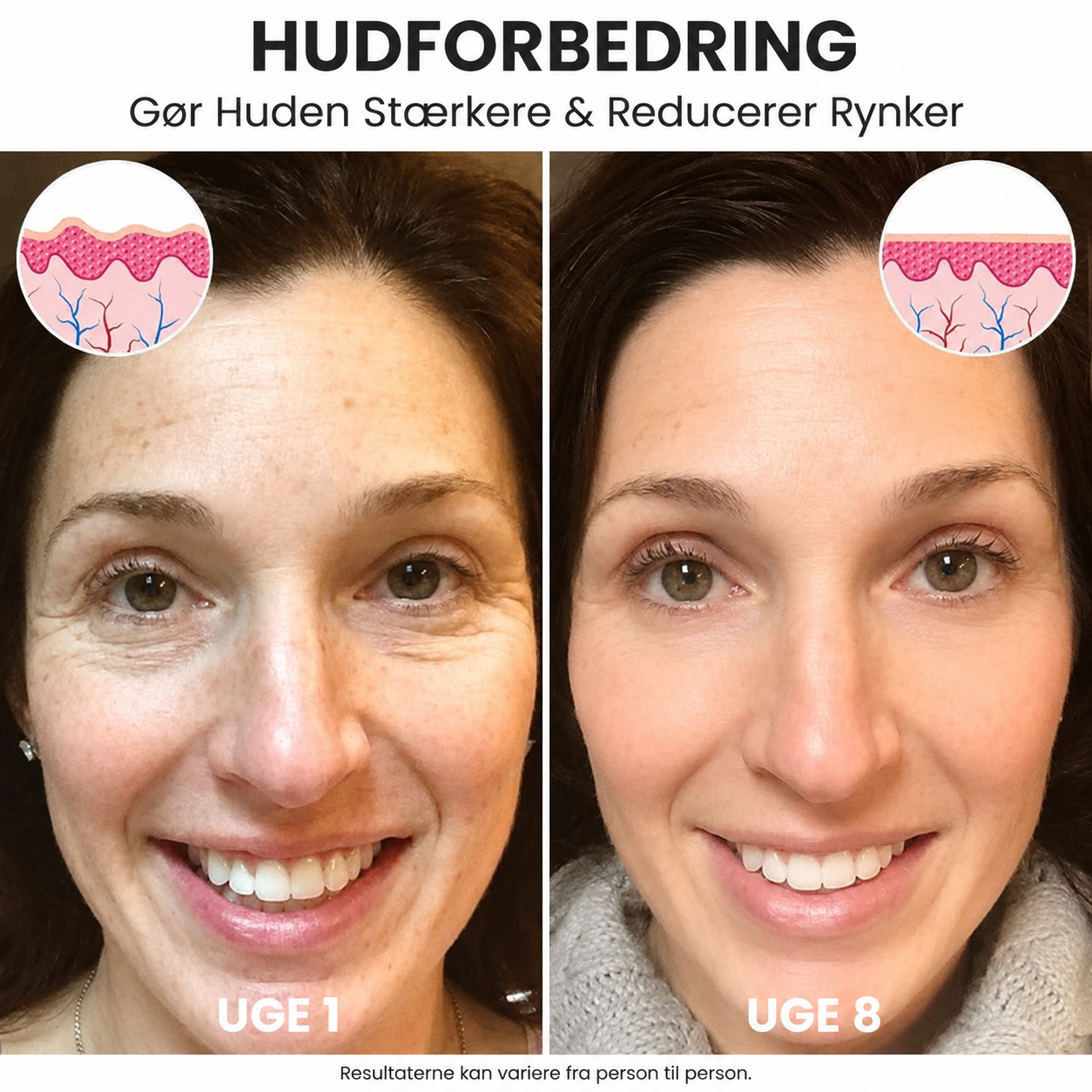SkinLift™ | Botox-ansigtsserum