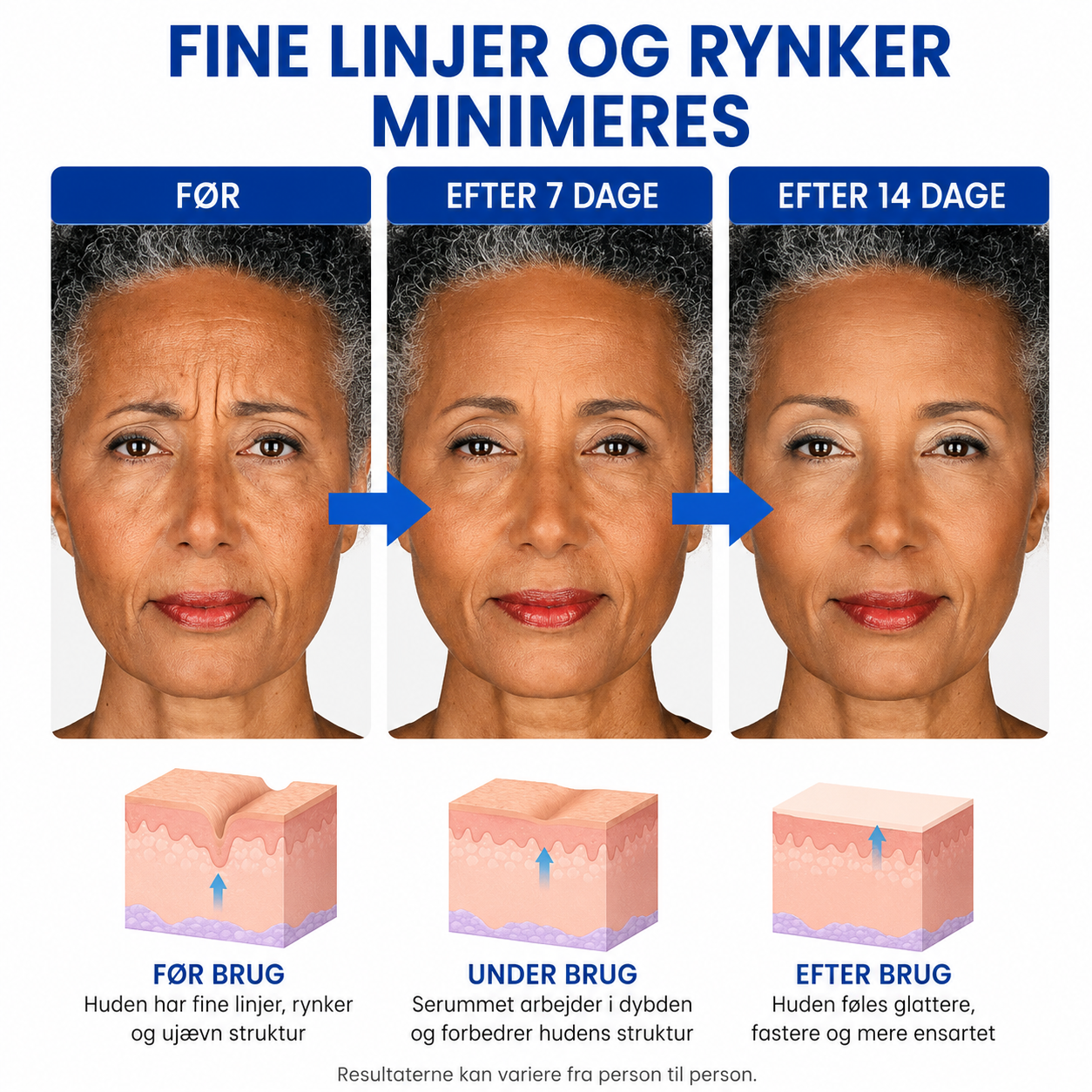SkinLift™ | Botox-ansigtsserum