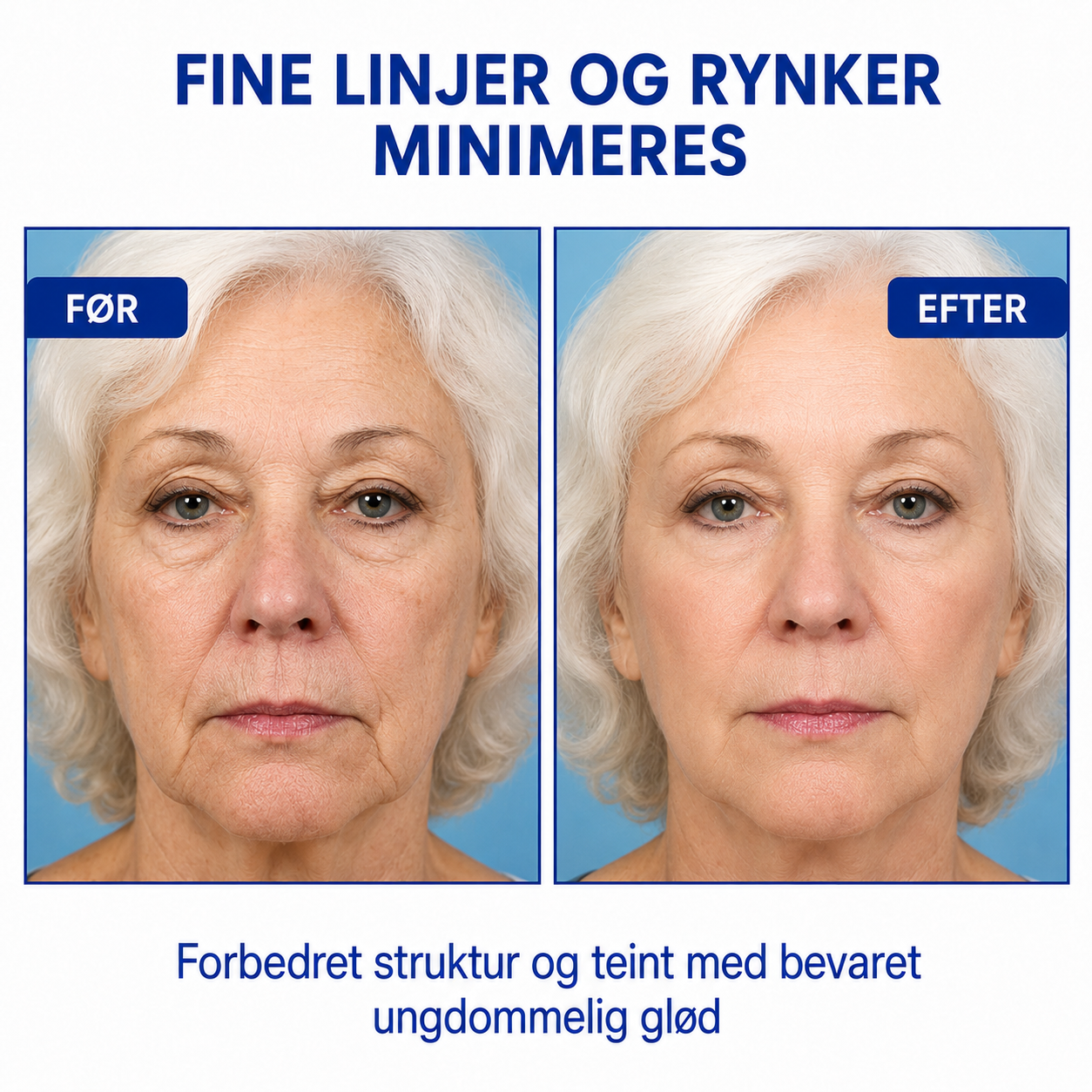SkinLift™ | Botox-ansigtsserum