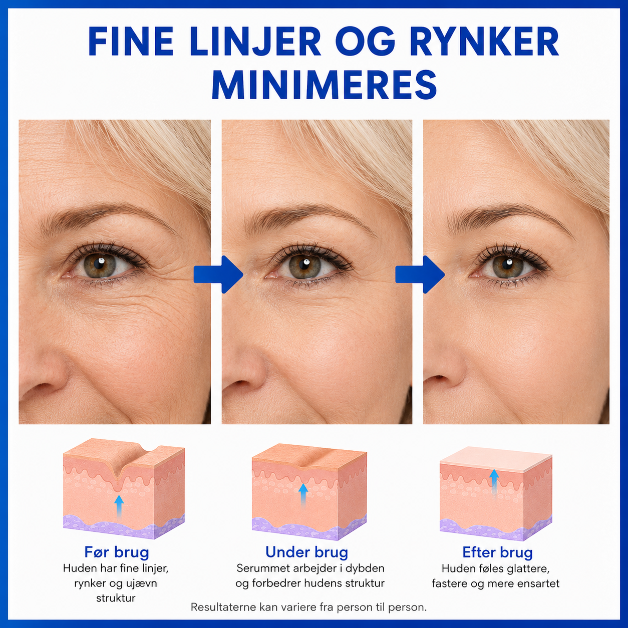 SkinLift™ | Botox-ansigtsserum
