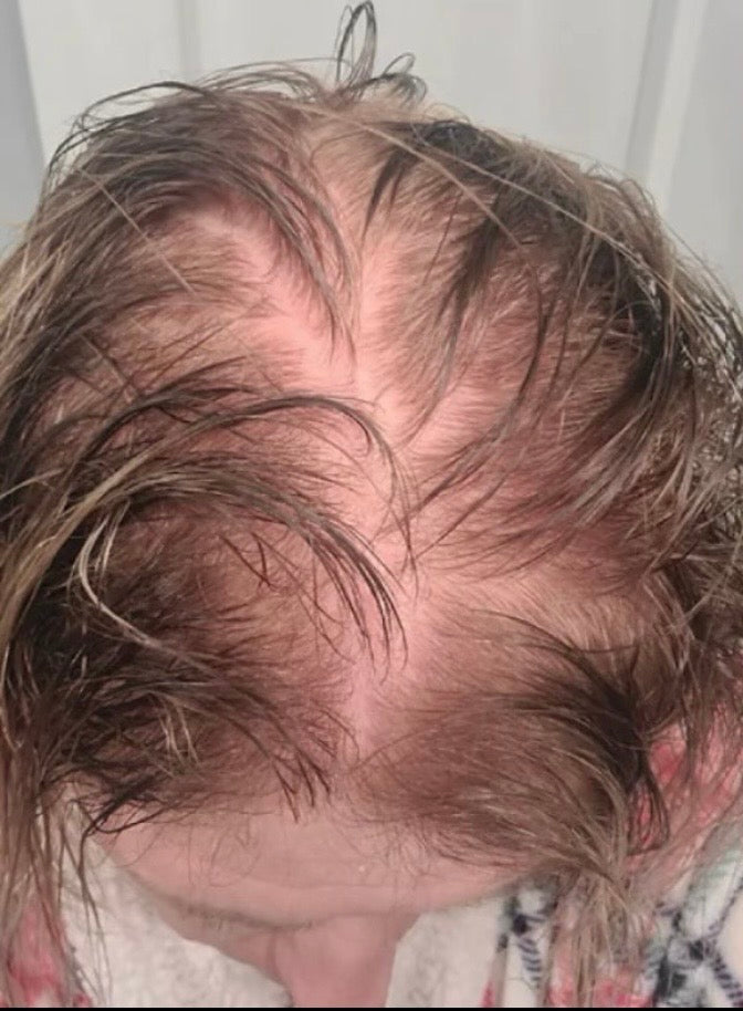 Mindre hårtab - Before