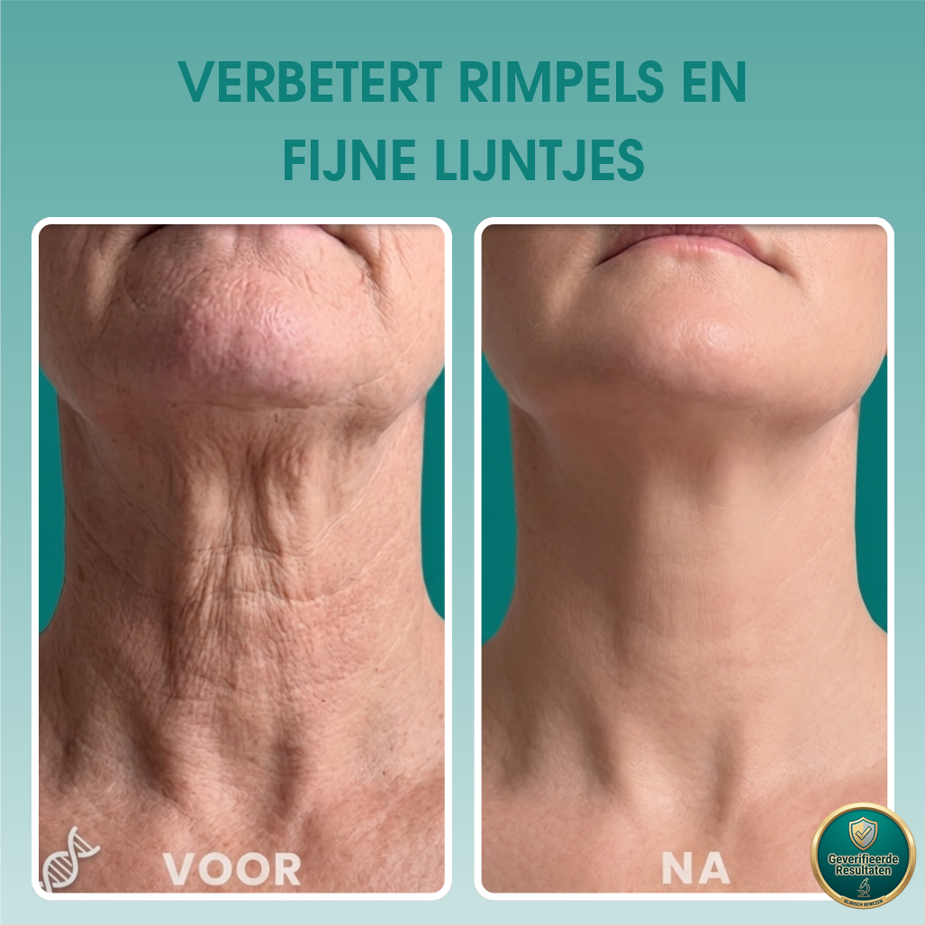 1+1 GRATIS: FirmLux™ | Verstevigende Crème