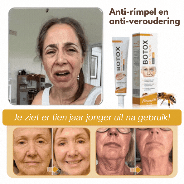Anti-Wrinkle™ | Rynkereducerende Botox Creme