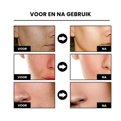 NiaRadiant™ | Hududglattende Serum