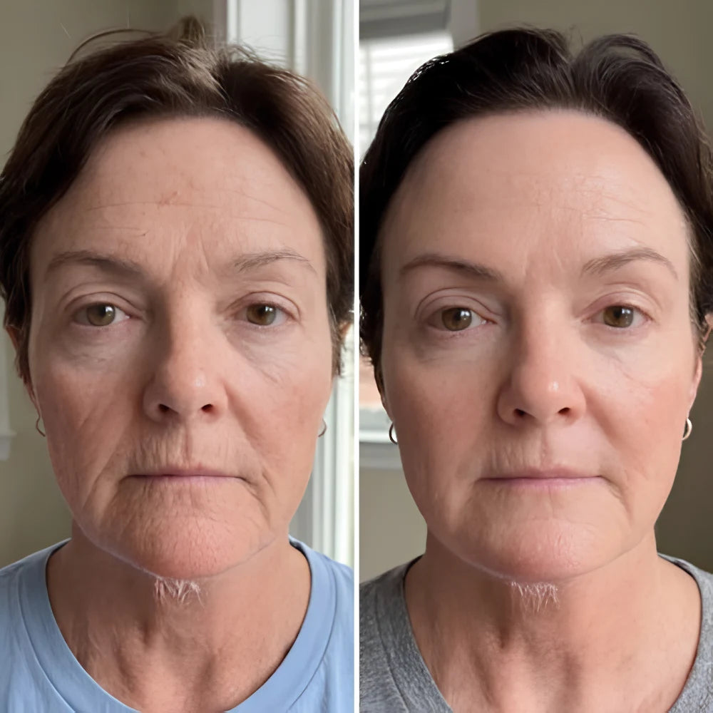 Nærende Oksetalg Hudcreme Til Tør Og Belastet Hud, before/after 3